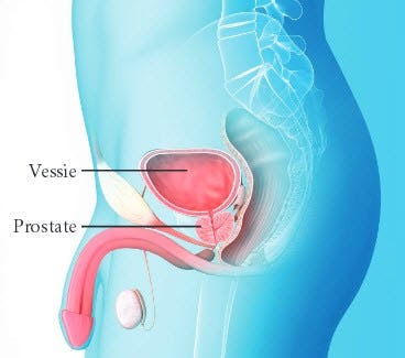 Prostate 